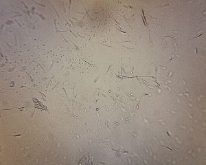 microscope image of live boar semen
