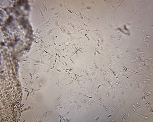 microscope image of live boar semen