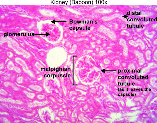 kidney slide labeled