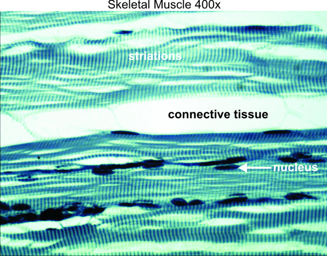 Skeletal Muscle 400x Dissection Connection